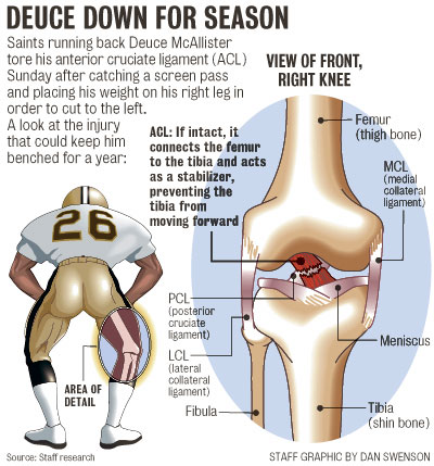 Acl Tear Images